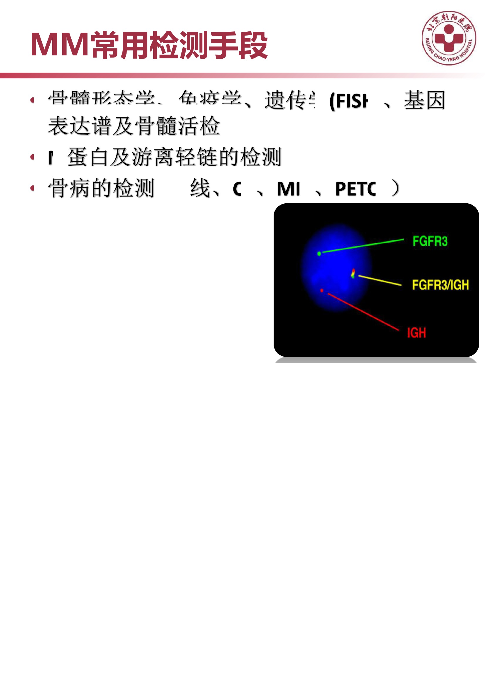 多发性骨髓瘤的诊治策略 5.jpeg