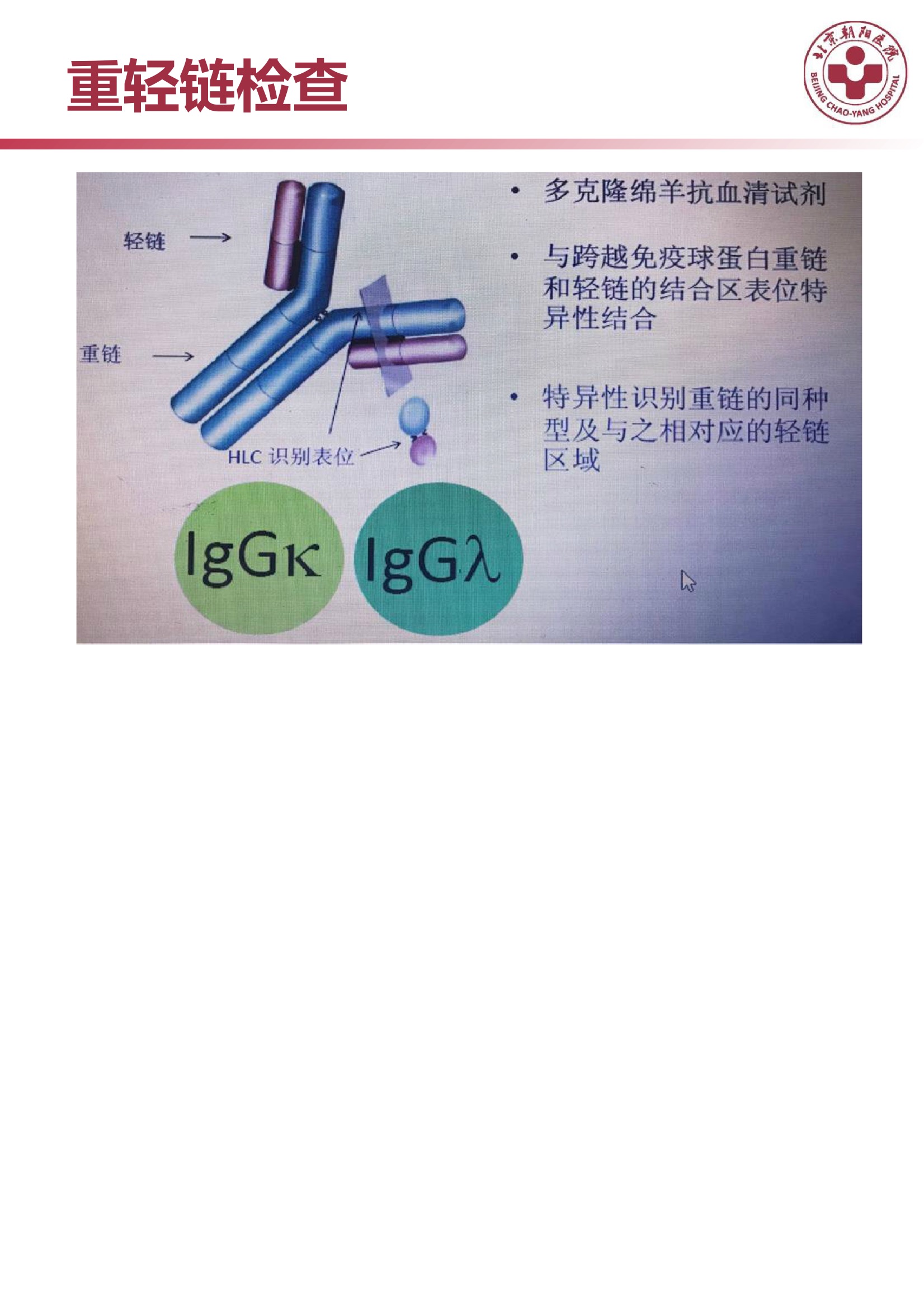 多发性骨髓瘤的诊治策略 10.jpeg