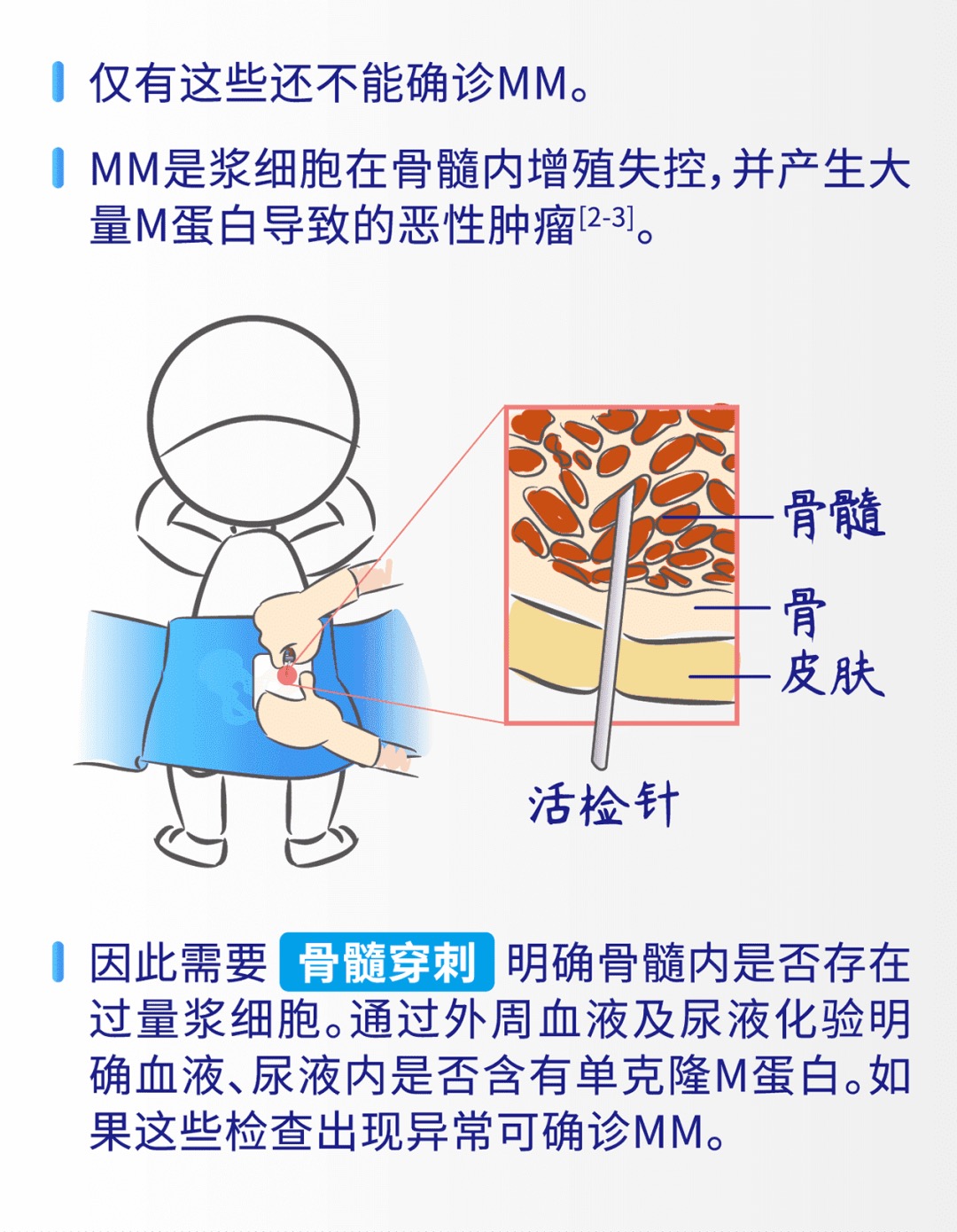 骨髓瘤检测4.png